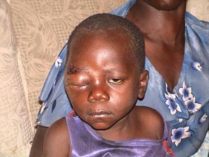 Si bien el abuso físico es el más visible, existen otros tipos de abuso infantil - © Sokwanele