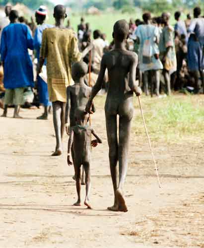Malnutrition hampers children’s healthy development